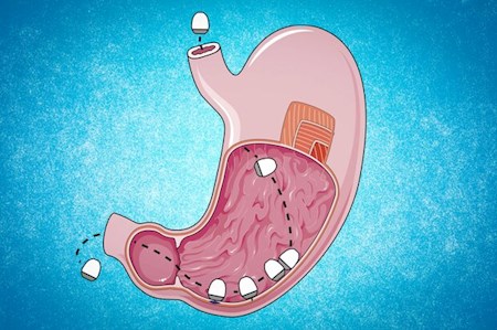 واکسن های mRNA به قرص تبدیل شدند