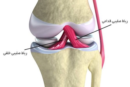 دادن رباط کابوس ستاره های لیگ