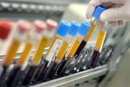 صدور حکم محرومیت ۲۴ ورزشکار دوپینگی