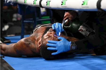 بوکسور آمریکایی بیهوش شد